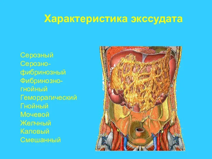 Характеристика экссудата Серозный Серозно-фибринозный Фибринозно-гнойный Геморрагический Гнойный Мочевой Желчный Каловый Смешанный