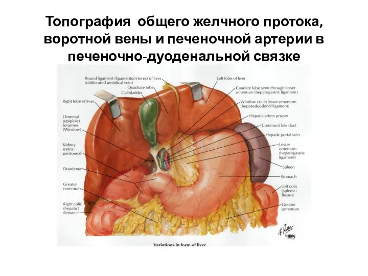 Топография общего желчного протока, воротной вены и печеночной артерии в печеночно-дуоденальной связке
