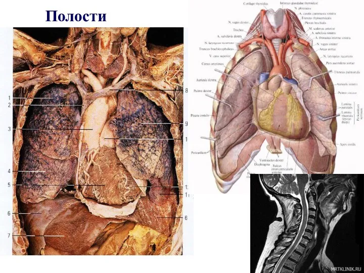 Полости