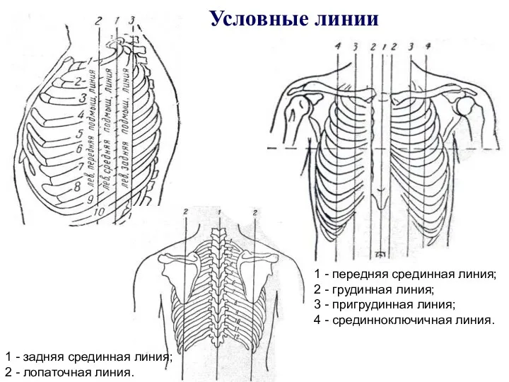 Условные линии 1 - передняя срединная линия; 2 - грудинная