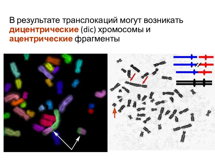 В результате транслокаций могут возникать дицентрические (dic) хромосомы и ацентрические фрагменты