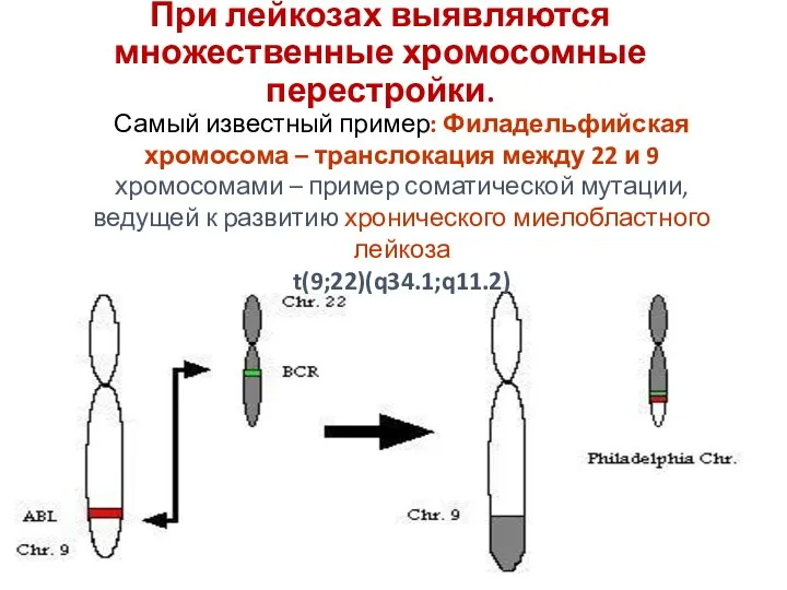 При лейкозах выявляются множественные хромосомные перестройки. Самый известный пример: Филадельфийская