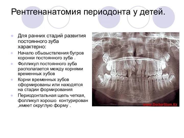 Рентгенанатомия периодонта у детей. Для ранних стадий развития постоянного зуба