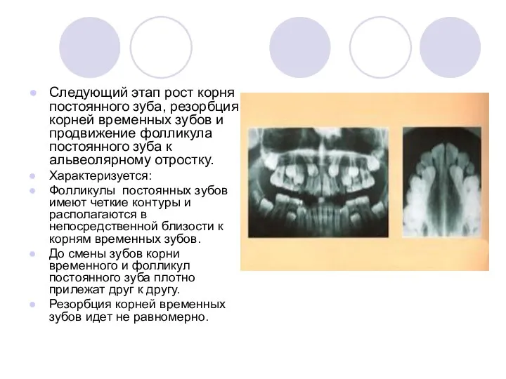 Следующий этап рост корня постоянного зуба, резорбция корней временных зубов