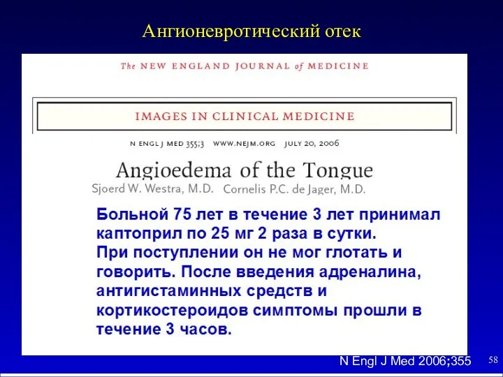 Ангионевротический отек N Engl J Med 2006;355