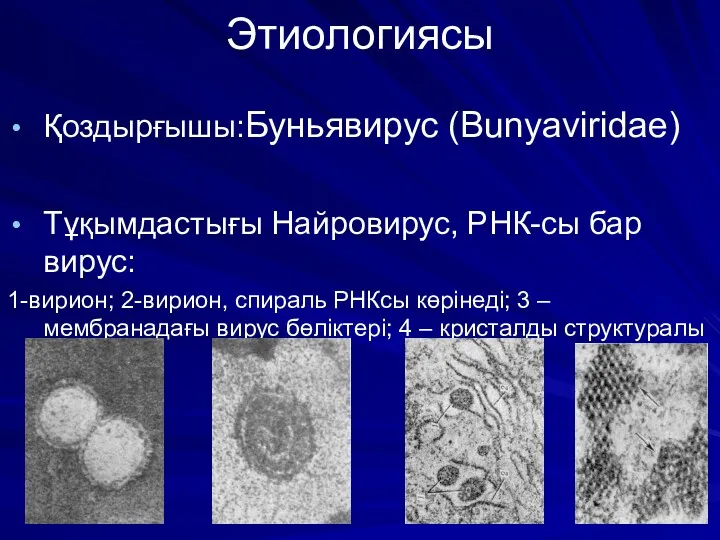 Этиологиясы Қоздырғышы:Буньявирус (Bunyaviridae) Тұқымдастығы Найровирус, РНК-сы бар вирус: 1-вирион; 2-вирион, спираль РНКсы көрінеді;