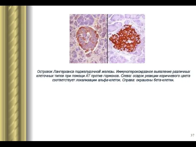 Островок Лангерханса поджелудочной железы. Иммунопероксидазное выявление различных клеточных типов при