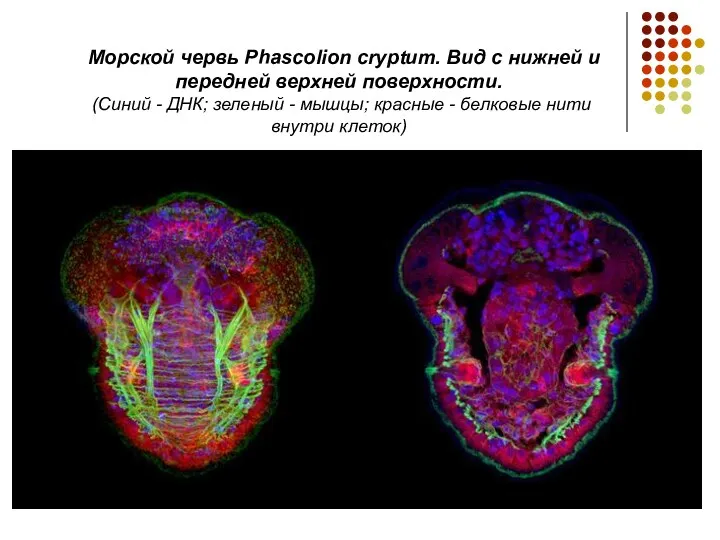 Морской червь Phascolion cryptum. Вид с нижней и передней верхней