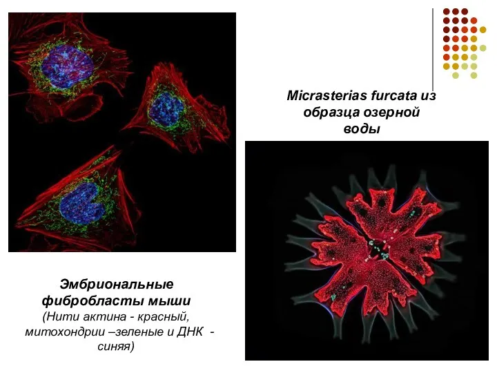Micrasterias furcata из образца озерной воды Эмбриональные фибробласты мыши (Нити