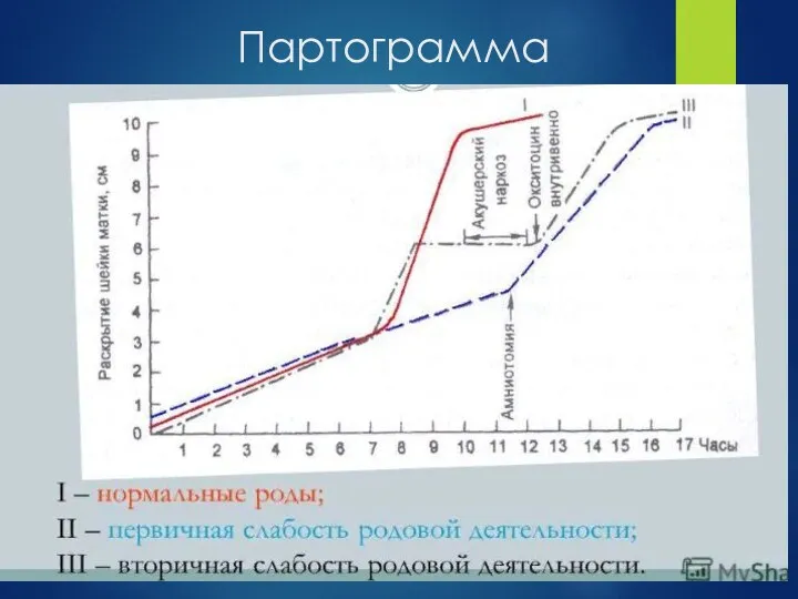 Партограмма