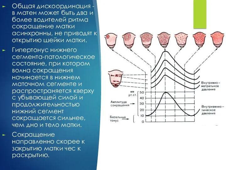 Общая дискоординация - в матен может быть два и более