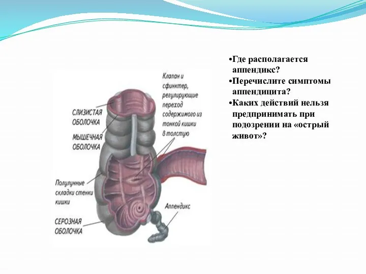 Где располагается аппендикс? Перечислите симптомы аппендицита? Каких действий нельзя предпринимать при подозрении на «острый живот»?