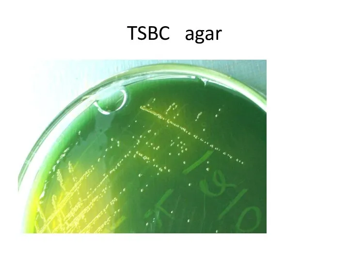 TSBC agar