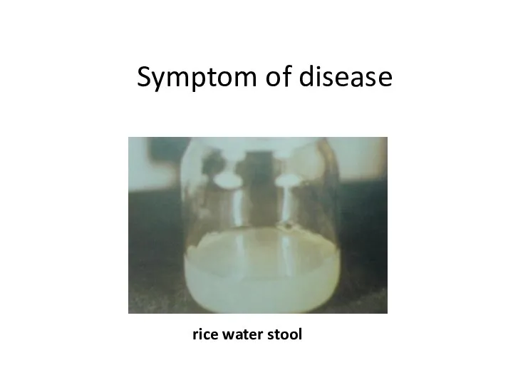 Symptom of disease rice water stool