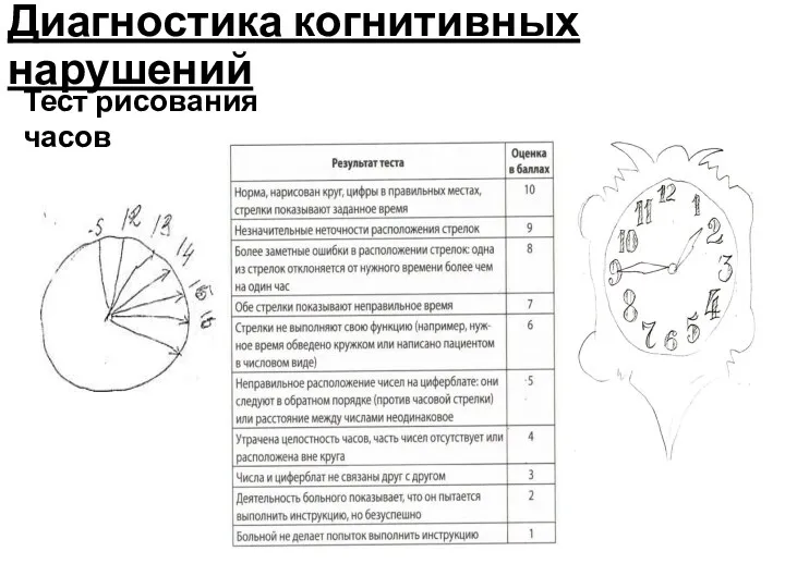 Тест рисования часов Диагностика когнитивных нарушений