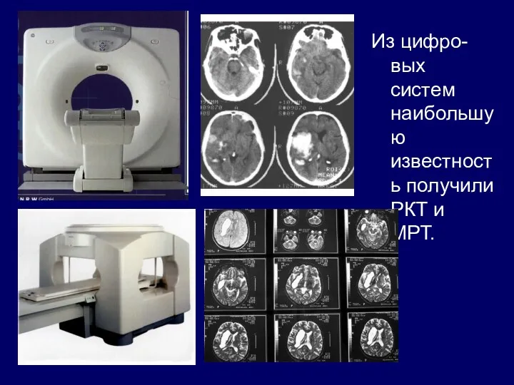Из цифро-вых систем наибольшую известность получили РКТ и МРТ.
