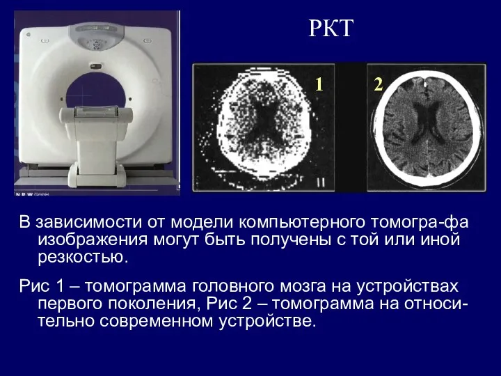 РКТ В зависимости от модели компьютерного томогра-фа изображения могут быть