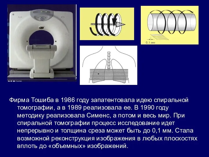 Фирма Тошиба в 1986 году запатентовала идею спиральной томографии, а