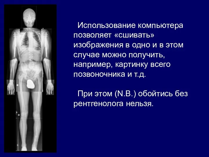 Использование компьютера позволяет «сшивать» изображения в одно и в этом