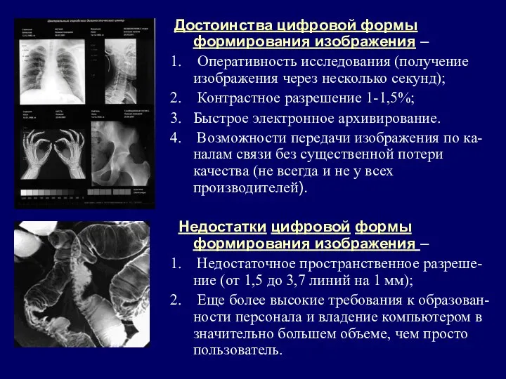 Достоинства цифровой формы формирования изображения – Оперативность исследования (получение изображения