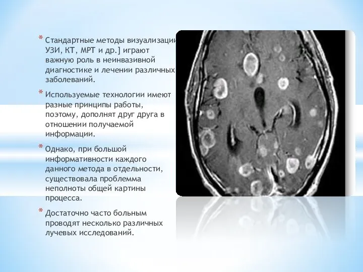 Стандартные методы визуализации УЗИ, КТ, МРТ и др.] играют важную