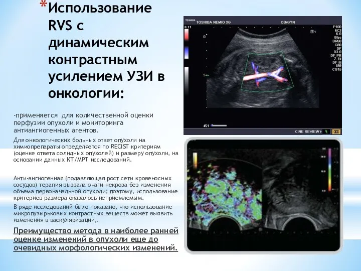 Использование RVS с динамическим контрастным усилением УЗИ в онкологии: -применяется