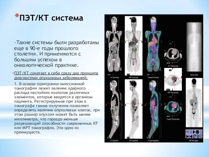 ПЭТ/КТ система -Такие системы были разработаны еще в 90-е годы