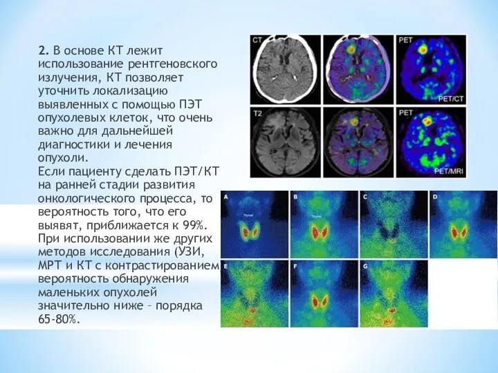 2. В основе КТ лежит использование рентгеновского излучения, КТ позволяет