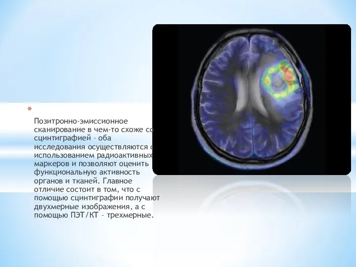 Позитронно-эмиссионное сканирование в чем-то схоже со сцинтиграфией – оба исследования
