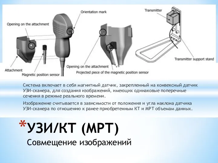 Система включает в себя магнитный датчик, закрепленный на конвексный датчик