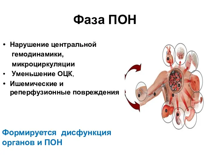 Фаза ПОН Нарушение центральной гемодинамики, микроциркуляции Уменьшение ОЦК, Ишемические и