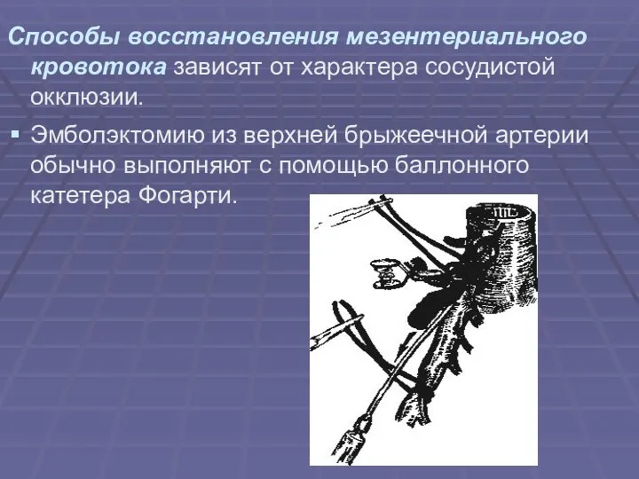 Способы восстановления мезентериального кровотока зависят от характера сосудистой окклюзии. Эмболэктомию