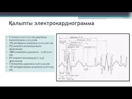 Қалыпты электрокардиограмма P тісшесі 0,07-0,10 сек ұзақтығы. Амплитудасы 1,5-2,5 мм.