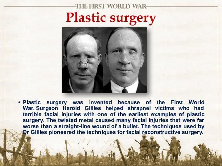 Plastic surgery Plastic surgery was invented because of the First World War. Surgeon