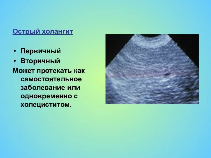 Острый холангит Первичный Вторичный Может протекать как самостоятельное заболевание или одновременно с холециститом.