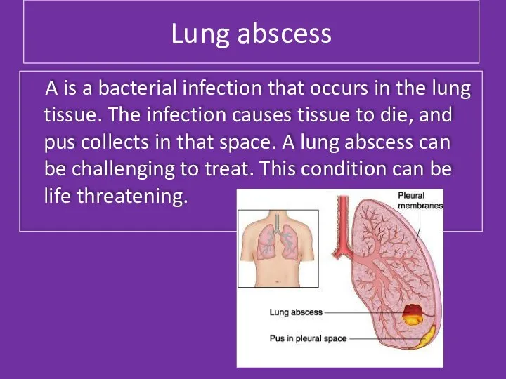 Lung abscess A is a bacterial infection that occurs in