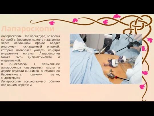 Лапароскопия Лапароскопия − это процедура, во время которой в брюшную полость пациентки через