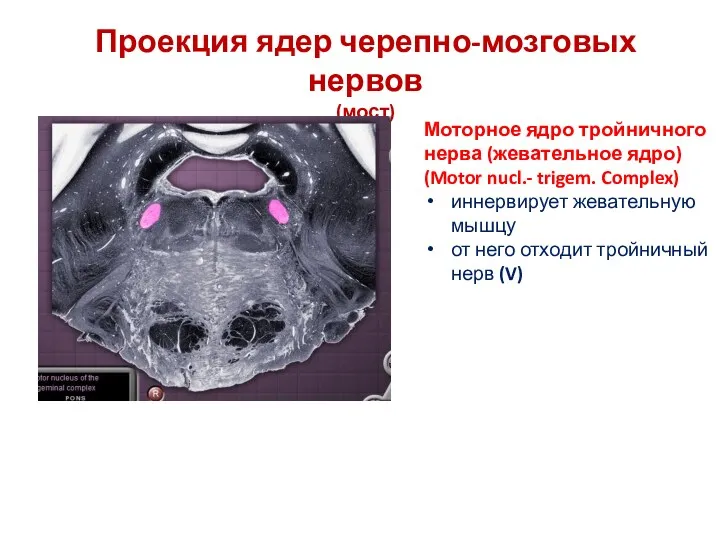 Проекция ядер черепно-мозговых нервов (мост) Моторное ядро тройничного нерва (жевательное