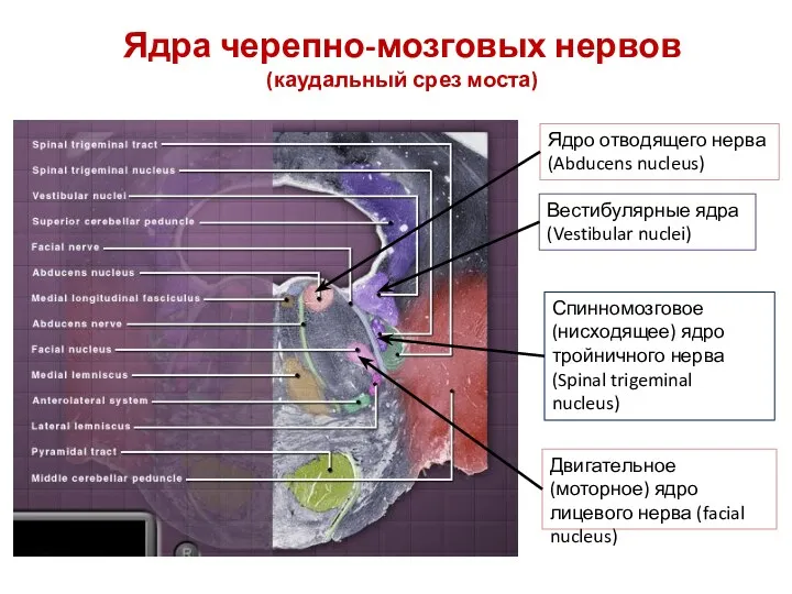 Ядра черепно-мозговых нервов (каудальный срез моста) Спинномозговое (нисходящее) ядро тройничного