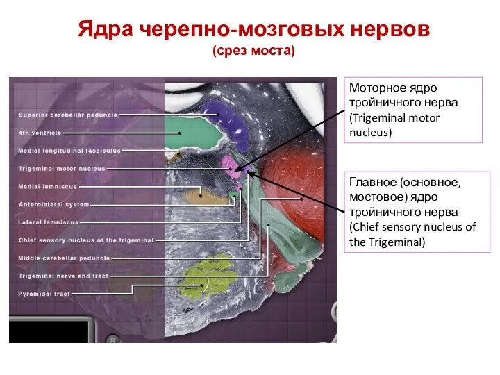 Ядра черепно-мозговых нервов (срез моста) Моторное ядро тройничного нерва (Trigeminal