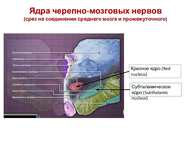 Ядра черепно-мозговых нервов (срез на соединении среднего мозга и промежуточного)