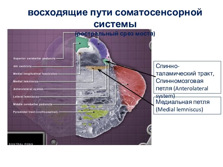 восходящие пути соматосенсорной системы (ростральный срез моста) Медиальная петля (Medial