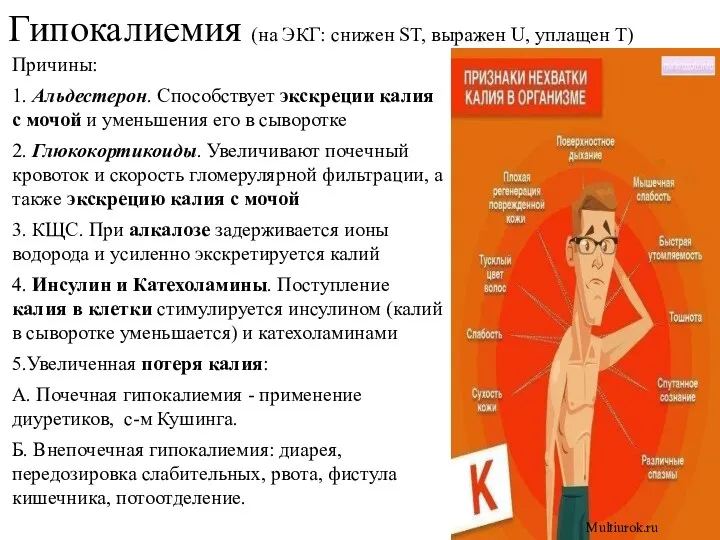 Причины: 1. Альдестерон. Способствует экскреции калия с мочой и уменьшения