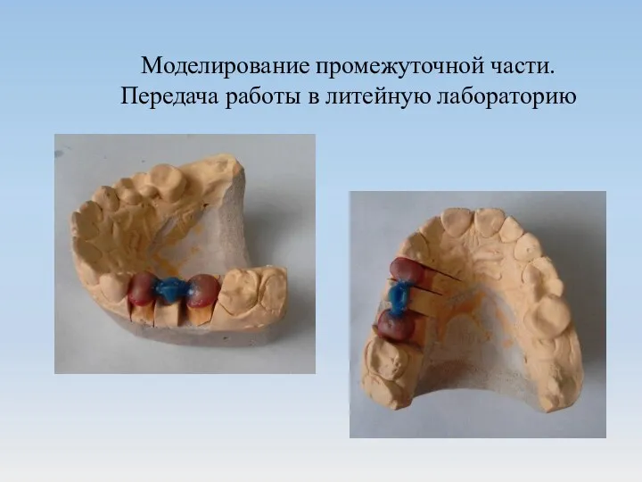 Моделирование промежуточной части. Передача работы в литейную лабораторию