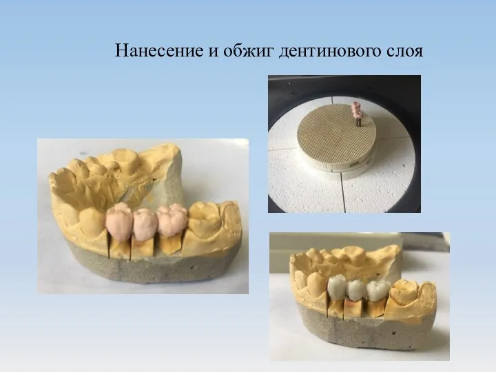 Нанесение и обжиг дентинового слоя