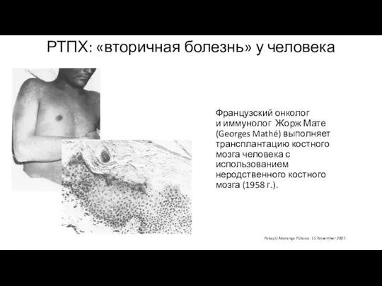 Французский онколог и иммунолог Жорж Мате (Georges Mathé) выполняет трансплантацию