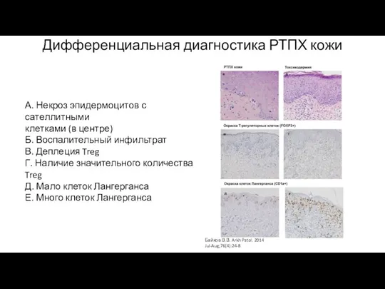 А. Некроз эпидермоцитов с сателлитными клетками (в центре) Б. Воспалительный