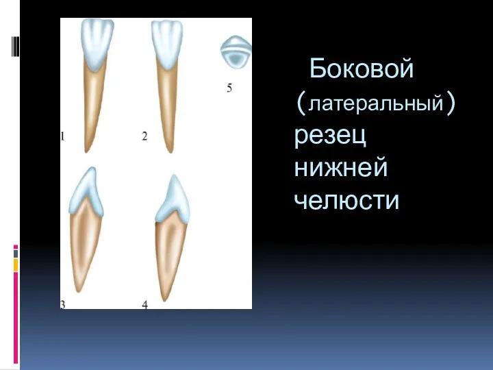 Боковой (латеральный) резец нижней челюсти