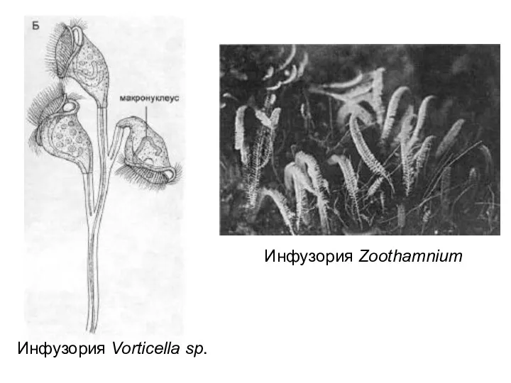 Инфузория Vorticella sp. Инфузория Zoothamnium