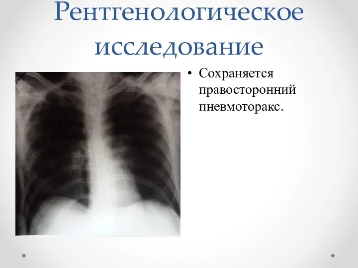 Рентгенологическое исследование Сохраняется правосторонний пневмоторакс.